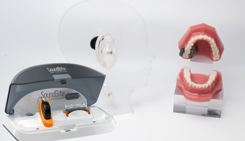 SoundBite®-